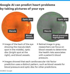 Google AI Revolution: predicting cardiovascular diseases through eye scan