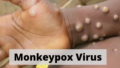 Edo confirms eight cases of monkeypox as govt intensifies efforts to contain outbreak