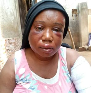 Brutalized female journalist - journalists demand justice