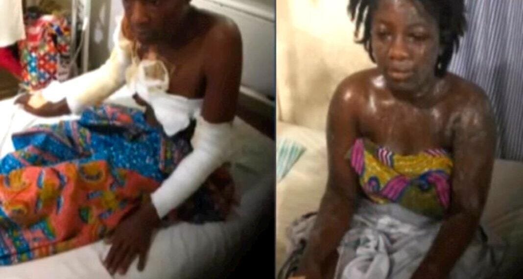 Sugar daddy, 54, pours acid on girlfriend, 18