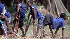 children suffering from polio