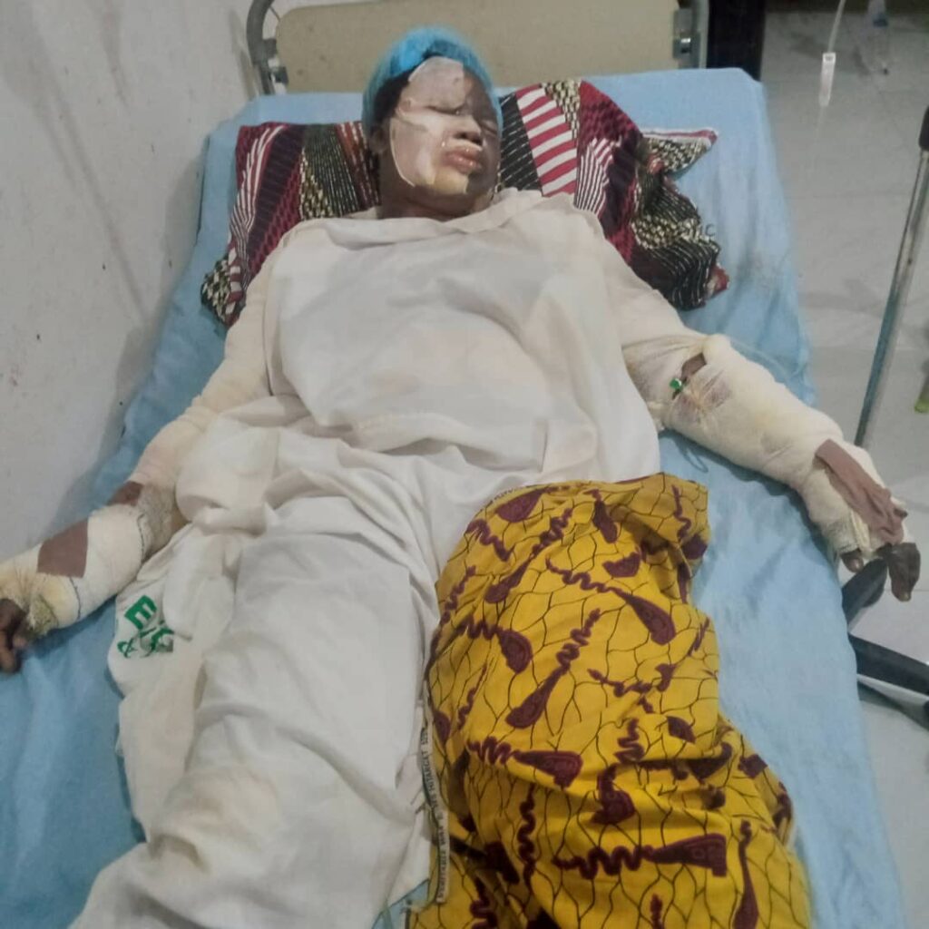 Tragic gas explosion at catering School claims 1 life, leaves 9 burned in Ebonyi