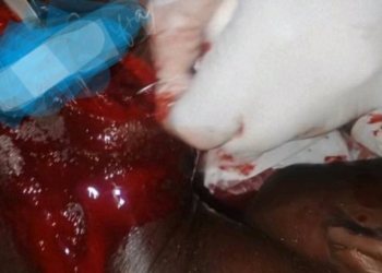 Rival cult clash in Delta State leaves 1 critically injured