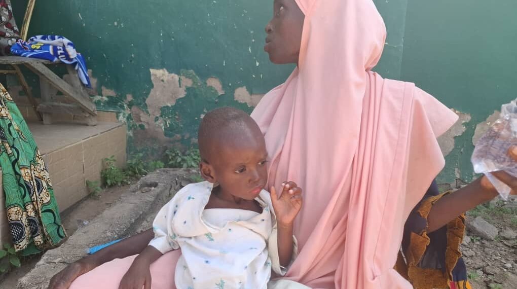 Children fight for survival over malnutrition in Taraba as experts raise alarm