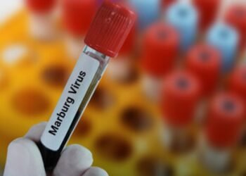 Marburg outbreak in Tanzania