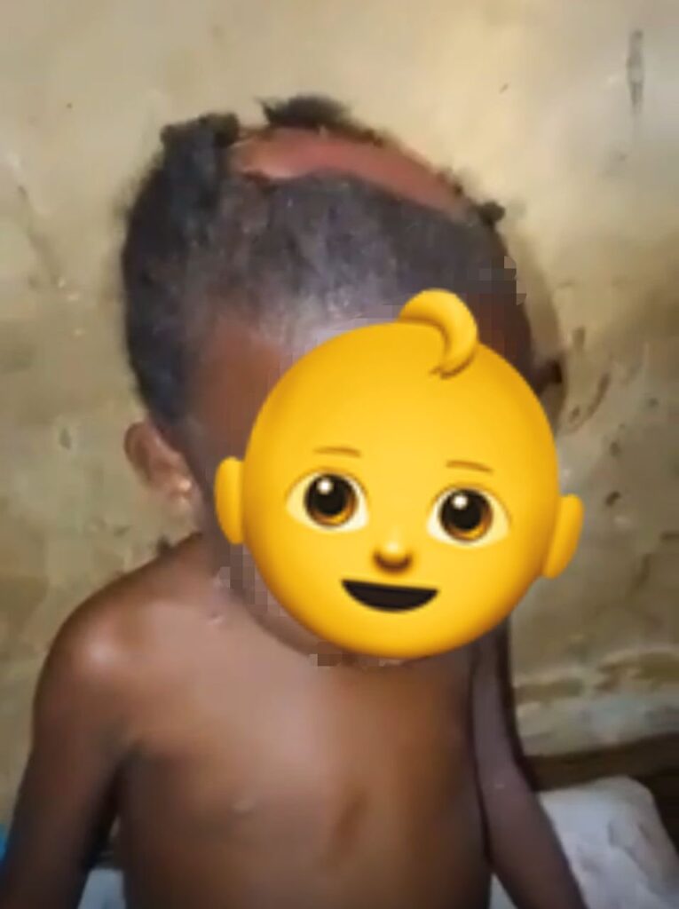 Police arrest woman for assaulting 5 year old