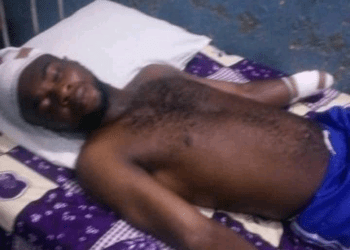 Outrage in Delta as Herdsmen amputate 28-year-old Man’s hand, community erupts in protest