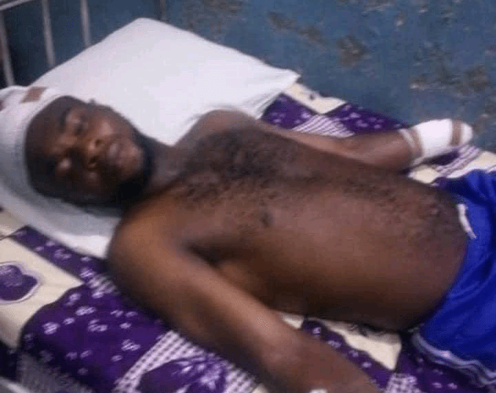 Outrage in Delta as Herdsmen amputate 28-year-old Man’s hand, community erupts in protest