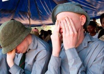 Albinism association urges FG to include skin treatment in NHIS