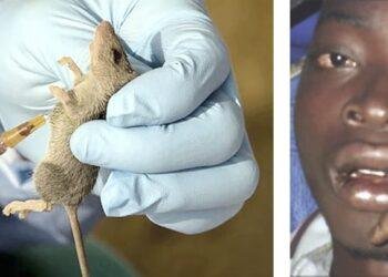 Lassa Fever