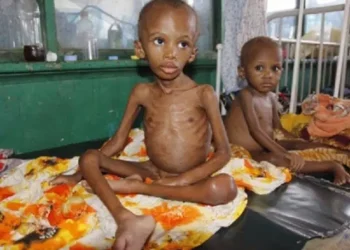 Surge in child malnutrition in the north is worrisome- Nwabueze