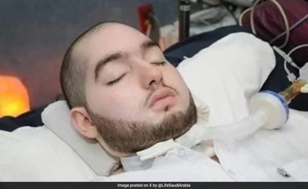 Saudi Prince in coma