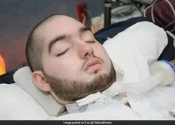 Saudi Prince in coma