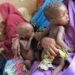 Kano, UNICEF to expend N1billion in feeding 17,000 malnourished children