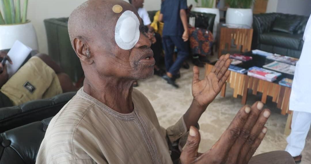 FCT NUJ provides free eye surgery for former chairman