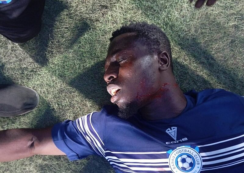 Chaos in Katsina: United Fans attack Player, slit opponent’s throat after equaliser in NPFL clash