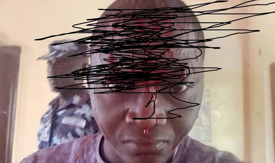 Alleged assault of journalist in Bauchi by police sparks outrage