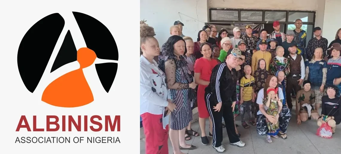 Albinism association demands inclusive approach to women’s issues in Nigeria