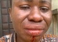 How Rivers LG boss, thugs brutalized lady for posting video of dilapidated school online