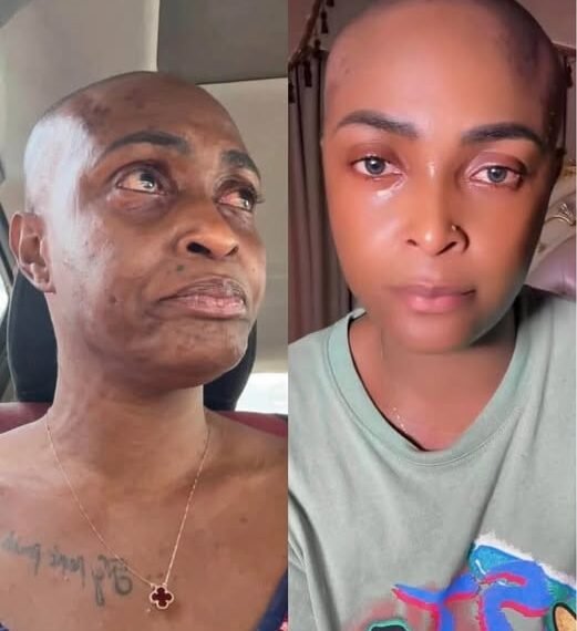 Blessing CEO says cancer stage unclear, addresses fundraising backlash