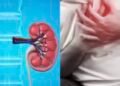 Dehydration, painkiller abuse driving surge in kidney disease cases, doctor warns