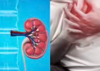 Dehydration, painkiller abuse driving surge in kidney disease cases, doctor warns