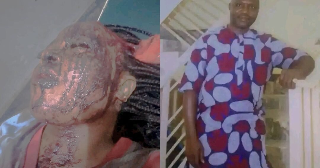 Woman battles for life after alleged stabbing by ex-husband in Taraba as Police launch manhunt