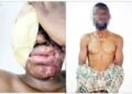 Lagos acid attack suspect says he received N500,000 to target woman but attacked wrong victim