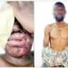 Lagos acid attack suspect says he received N500,000 to target woman but attacked wrong victim