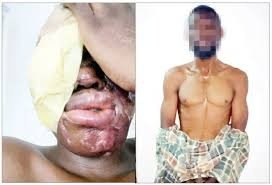 Lagos acid attack suspect says he received N500,000 to target woman but attacked wrong victim