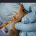 NCDC Lassa fever deaths