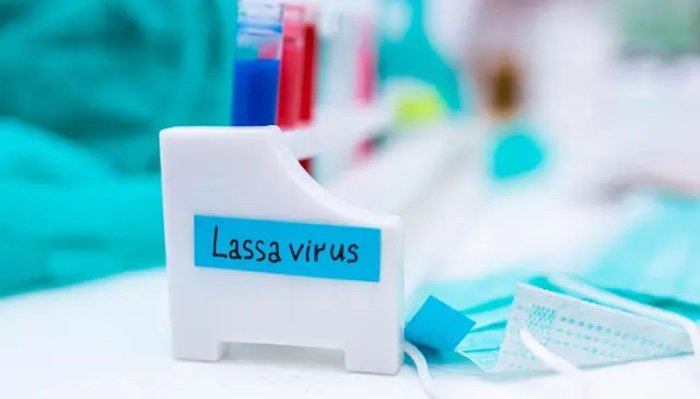 Nigeria Records 1,000 Cases, 237 Deaths From Lassa Fever Across 23 States