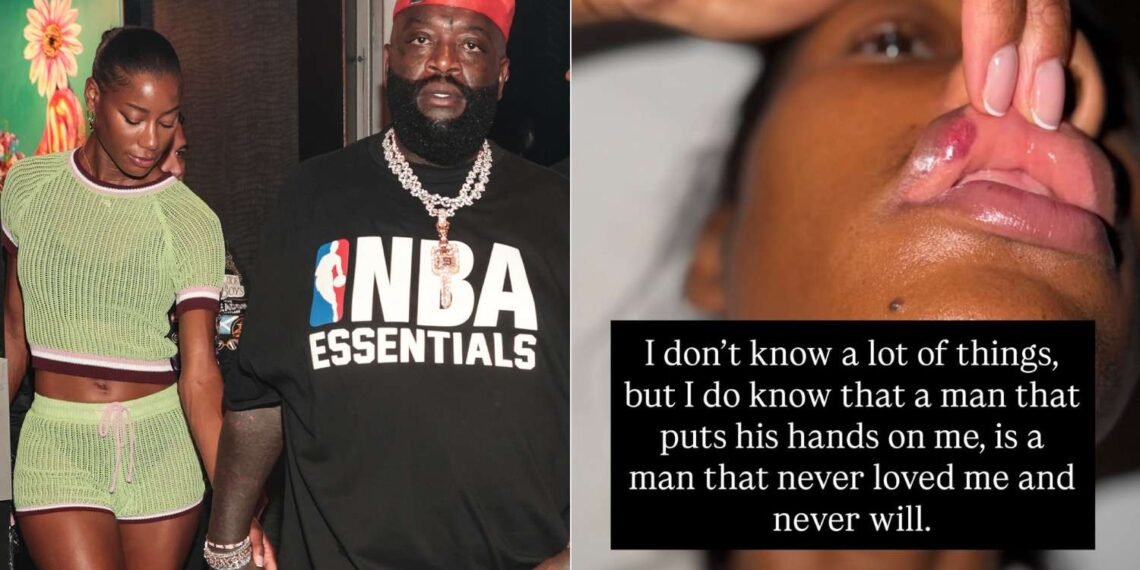 Jazma Kendrick Accuses Rick Ross of Physical Assault, Shares Alleged Injury Photos
