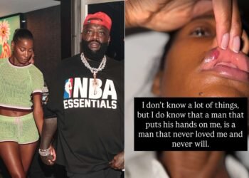 Jazma Kendrick Accuses Rick Ross of Physical Assault, Shares Alleged Injury Photos