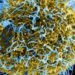 Ebola outbreak in DRC