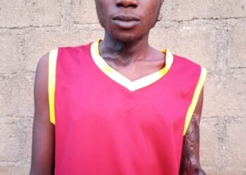Taraba Polytechnic Student Who Lost Both Hands to Electrocution Loses One Eye, Seeks Urgent Help