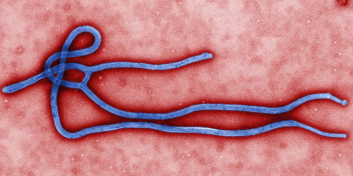 Ebola virus under electron microscope