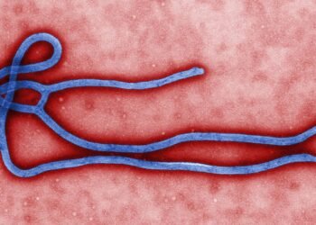 Kenya first Ebola death - Ebola virus under electron microscope